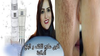 أفضل كريم و سيروم لعلاج الكلف و التصبغات + يساعد عل توحيد اللون  pigmentclar  la Roche-Posay