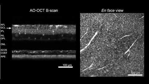 Cellular Scale Imaging of Transparent Retinal Structures and Processes: Supplemental Video 3
