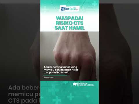 Video: Cara Tidur dengan Carpal Tunnel Syndrome Semasa Hamil