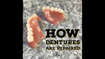 How Dentures Are Repaired/Fixed