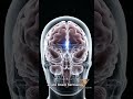 STOP Wrong Head Injury Care! Essential Updates for medical students #doctor #mbbs #TBI