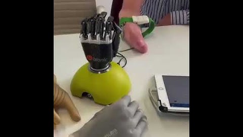 New Technologic Bionic Hand