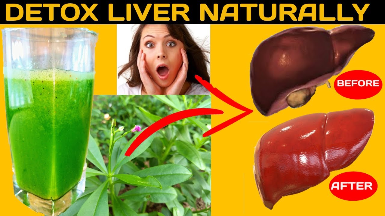 How To Detox Liver Or Cleanse Liver Naturally In 2 Days| Fatty Liver Natural Remedy