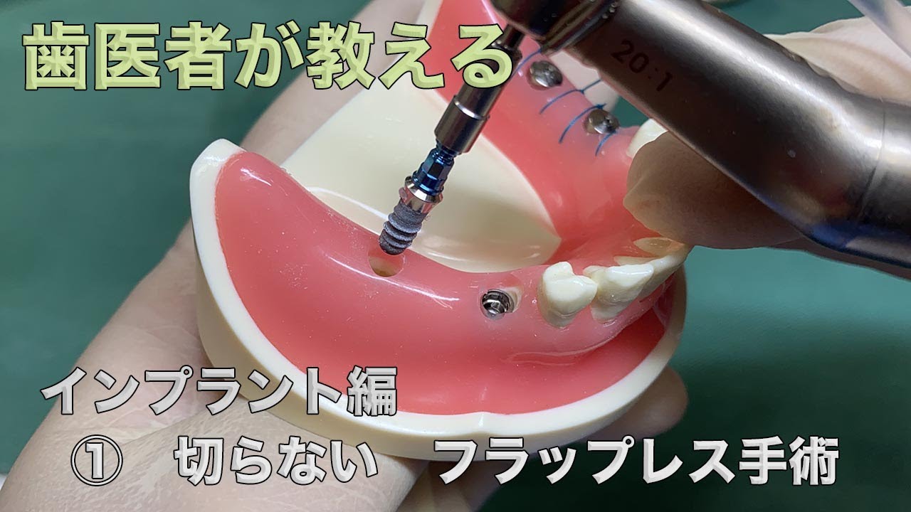 インプラント　フラップレス手術と通常の手術との比較
