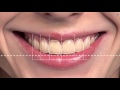 Digital Smile Design - Animation