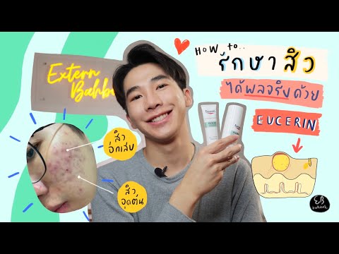 How to รักษาสิวได้ผลจริง ด้วยผลิตภัณฑ์จาก Eucerin  EB.Bahboh