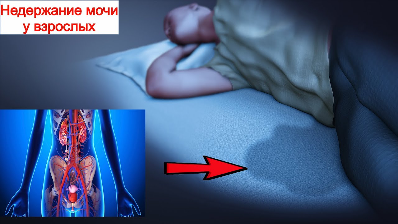 Ночное Недержание Мочи (Ночной энурез)
