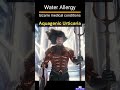 The RAREST Allergy: Why Water Can Be DANGEROUS... Water Allergy