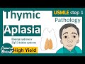 Thymic Aplasia | DiGeorge syndrome | 22q11.2 deletion syndrome | USMLE step 1