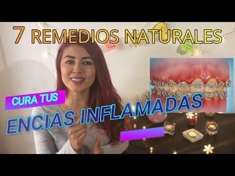 Vídeo: Remedios Caseros Para Las Encías Inflamadas