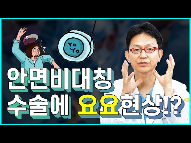 안면비대칭 수술 후 요요현상 원인은?!