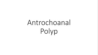 Antrochoanal Nasal Polyp - ENT