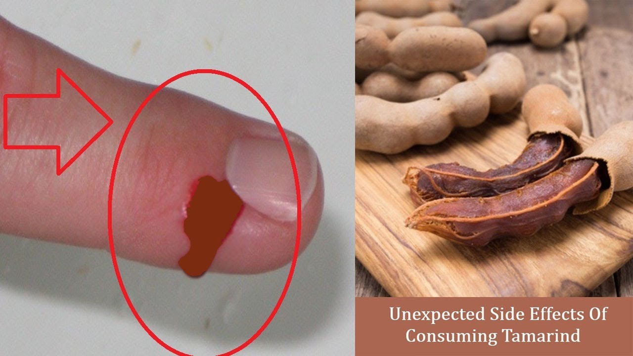 Top 10 Side Effects Of Tamarind Top 10 Side Effects Of Tamarind