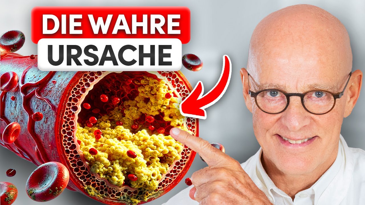 Top 8 LEBENSMITTEL um die Arterien zu reinigen (wichtig)