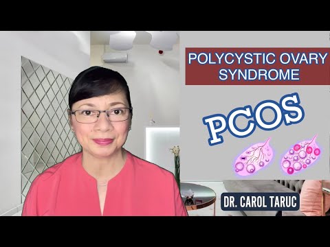 Video: Paano Magamot ang Polycystic Ovary Syndrome (PCOS): 11 Mga Hakbang