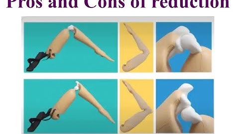 Elbow Dislocation Simulator | What happens inside! | Sports Medicine | Athletic Training Program