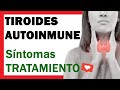 Tiroides Autoinmune o Tiroiditis de Hashimoto: SINTOMAS y TRATAMIENTO ✅
