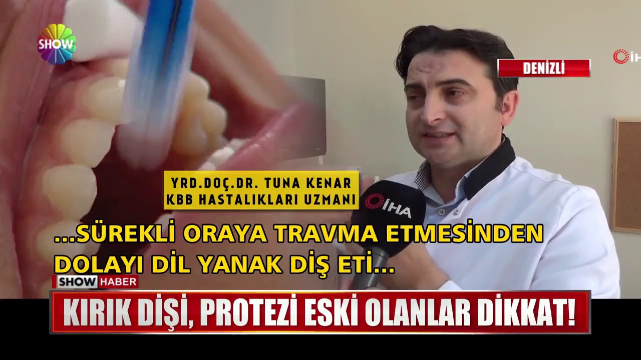 Kırık dişi dilini kesti, kanser oldu!