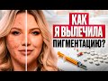 Как я вылечила ПИГМЕНТАЦИЮ? Личная история