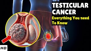 Testicular Cancer Explained Causes, How To Spot It Early, Diagnosis Best Treatment Options