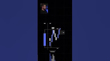 This Trading Strategy Works Everyday (Stupid Simple).