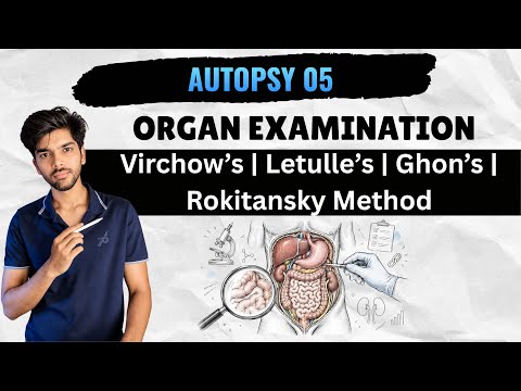Autopsy 05 - Organ Examination (Virchow’s | Letulle’s | Ghon’s | Rokitansky Methods of Organ Exam)