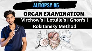 Full Autopsy 05 - Organ Examination (Virchow’s | Letulle’s | Ghon’s | Rokitansky Methods of Organ Exam) News