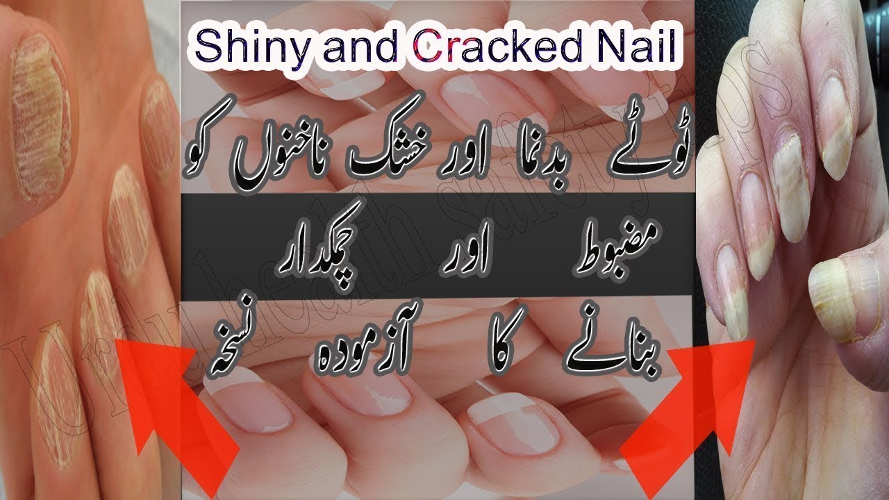 Dry and Cracked Nail Treatment Nail care Tips in Urdu YouTube