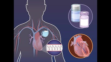 Katheterablatie bij ventriculaire tachycardie | NEJM