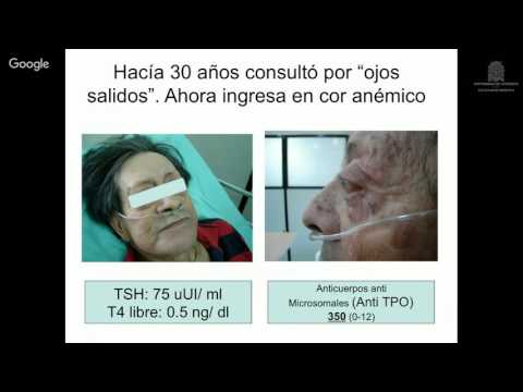 Video: Pruebas de Nivel Tiroideo / Pruebas de Profil Tiroideo / Hipotiroidismo Canino