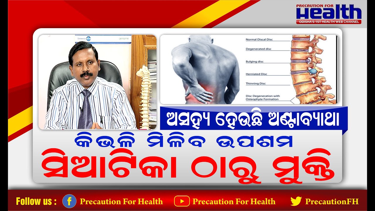 ଏଥର ମିଳିବ ସିଆଟିକା ଜନିତ ଅଣ୍ଟାବ୍ୟଥାରୁ ଉପଶମ । Best Treatment for Sciatica: Causes, Signs, and Diagnosis