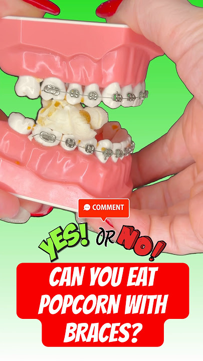 CAN YOU EAT POPCORN WITH BRACES? ASMR 🍿 #braces #poocorn #asmr