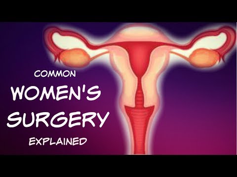 Common Women's Surgery, Gynaecological Surgery Explained