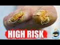 EXTREMELY HIGH RISK NAIL CUTTING OF SUPER THICK TOENAIL!!!