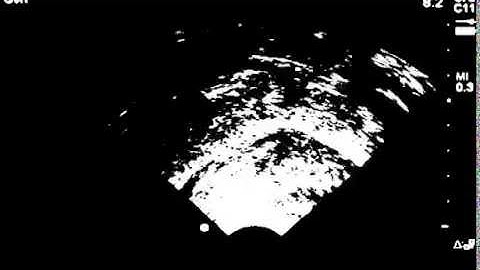 Gaussian blur with Otsu