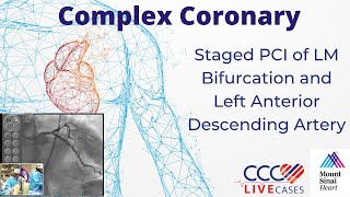 Staged PCI of LM Bifurcation and Left Anterior Descending Artery – Oct 2010 Webcast Video