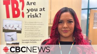 Indigenous communities continue stalled fight against tuberculosis