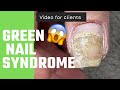Green nail syndrome | video for clients | S04