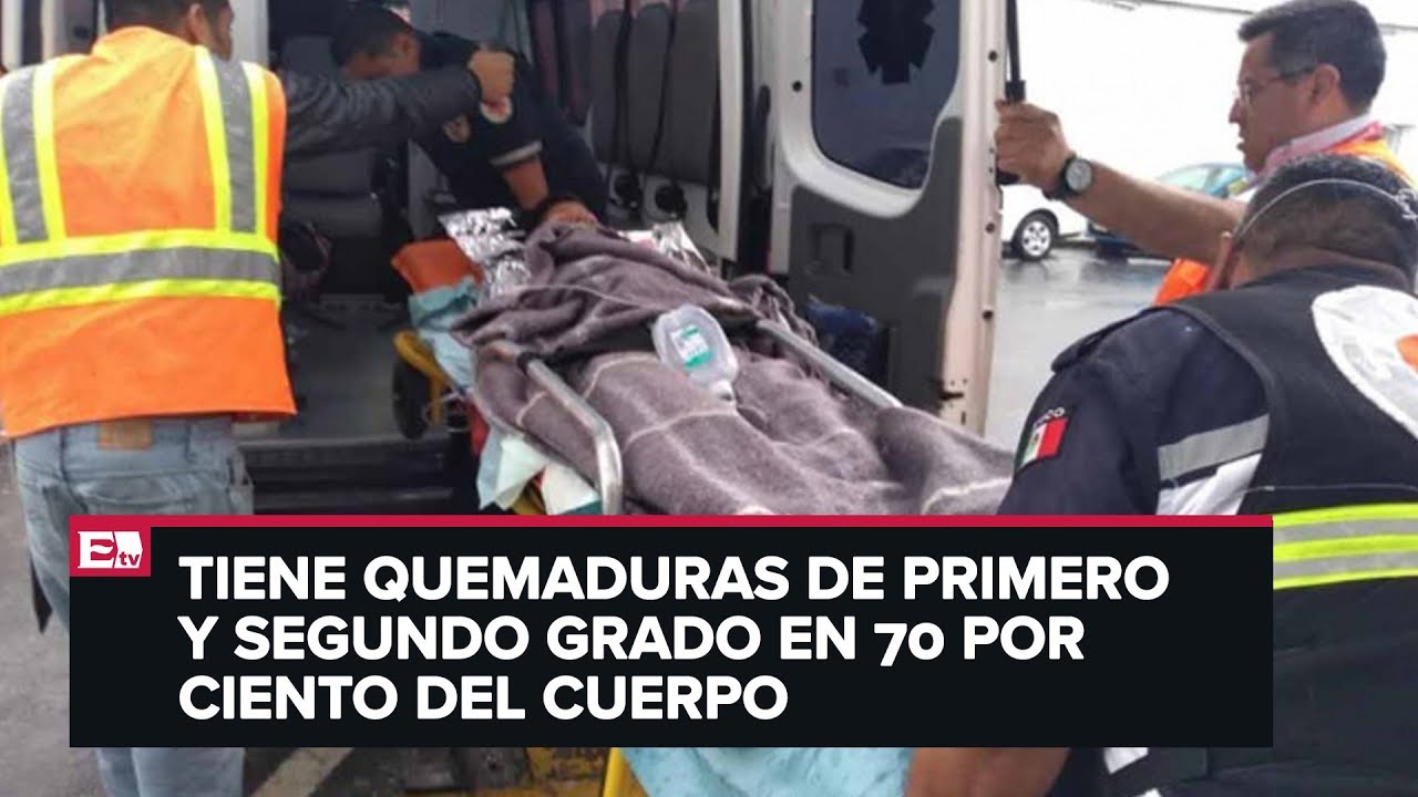 noticias hoy puerto rico Niño en Ecatepec recibe descarga eléctrica