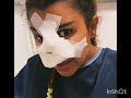 روفيا العنابية دارت عملية تجميل للانفها لي نهار كامل وانتم تتنمرو عليها روفيا العنابية دارت عملية تجميل للانفها لي نهار كامل وانتم تتنمرو عليها