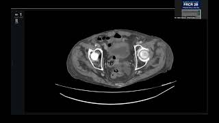 Abdominal emergency cases