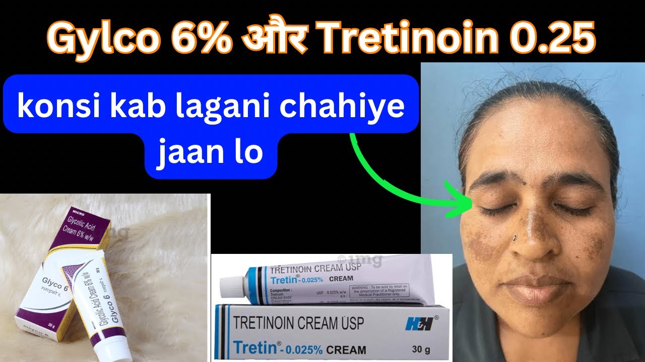 Glycolic acid 6 और tretinoin 0.25 konsi cream use Kare? pigmentation & pimples gyani taksh