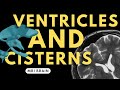 Ventricles and cisterns of the brain  radiology anatomy part 1 prep  mri brain