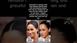 Celebrity Meghan Markle’s Face Sparks Speculation — But Fans Say She’s Still a Charming Lady Profile