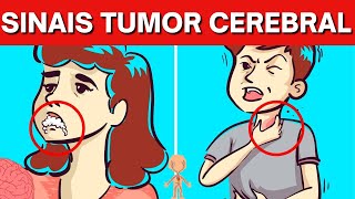 10 SINAIS de ALERTA de que você tem ou pode ter TUMOR CEREBRAL