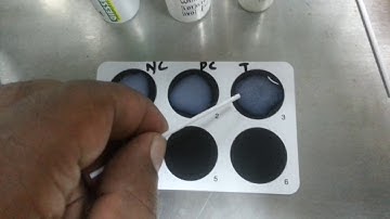 C-reactive protein (CRP) latex  test| CRP  Positive| Proper practical performance