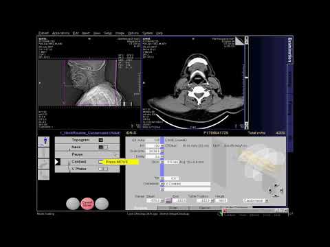 Video: Hnub twg ua CT scan rau tus mob coronavirus