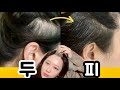 🌎cc) 두피마사지 (feat.소뿔괄사), scalp massage