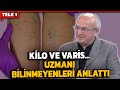 Varis problemi olanlar dikkat! Kalp ve Damar Cerrahı yapmanız gerekenleri tek tek anlattı