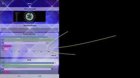 Genius Insight: Reporting Function